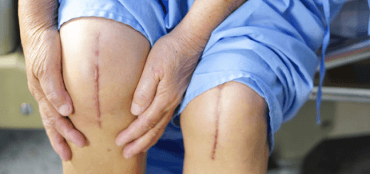 Joint replacement surgery