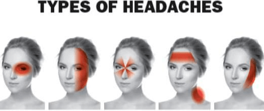 Types of Headaches